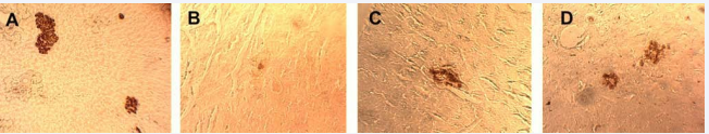  Figure 4 Pancreatic islets of animals in different groups, Magnification-800?  A – The passive control group  B – The active control group  C – The experimental group treated by lithium chloride  D – The experimental group treated by lithium carbonate