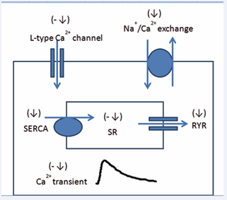 Figure 3 Diagram showing the proposed actions of STZ-induced diabetes on  Ca2+ transport systems in the ventricular  myocyte.  -=No effect, ?=Reduced  activity, ?=Increased activity.