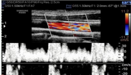  Example of poorly adjusted scales in doppler ultrasonography