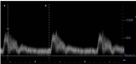  Speed spectrum for data and scale extraction.