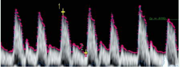 Contour points on the speed curve