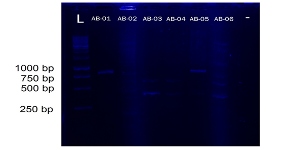 Figure 2A: Gel electropherogram for blaVIM-2 (865 bp)1st batch. Isolates AB-01, AB-02, AB-03, AB-04, AB-05, and AB-06 for blaVIM-2 detection; AB-01 and AB-05 are positive; DNA ladder (L); Negative control (-).