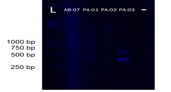 Figure 2B: Gel electropherogram for blaVIM-2 (865 bp) 2nd batch. Isolates, AB-07, PA-01, PA-02, and PA-03 for blaVIM-2 detection and all are negative for blaVIM-2, DNA ladder (L); Negative control (-).