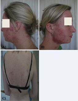 The patient before the treatment.