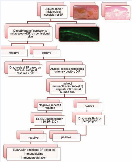 Stepwise diagnostic workup for the diagnosis of BP.