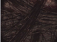 Whitish nodes distributed irregularly along the shaft (20x).