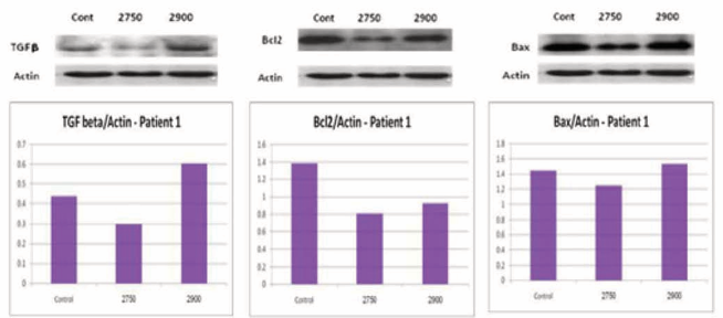 TGF?, Bcl2 and BAX levels in normal fibroblasts with and without ceramide analogous.