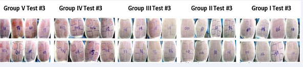 Skin reactions of groups I through V at 24 hours post application of poison ivy urushiol in Test #3.Skin reaction of guinea pigs at 24  hours post challenge of test #3. Guinea pigs in different groups were treated IM as follows: Group I:  ELI 21-57-3; Group II: ELI 21-78-1; Group III:  ELI 21-83; Group IV: 5% EtOH, and Group V: PBS. Two weeks post IM treatment; guinea pigs were sensitized with 1.0 mg urushiol on neck area.  Eleven weeks after sensitization, the guinea pigs were challenged with acetone or acetone containing 3.0, 4.5, or 6.0 µg urushiol at each of the four  abdominal sites.