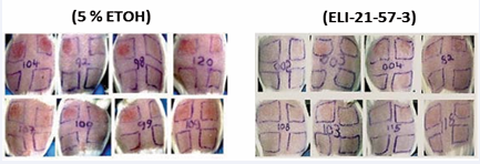 Skin reaction to poison ivy urushiol challenge at 72 hours. Previously sensitized guinea pigs were treated IM with ELI-21-57-3 (HDC-APB)  or 5% EtOH