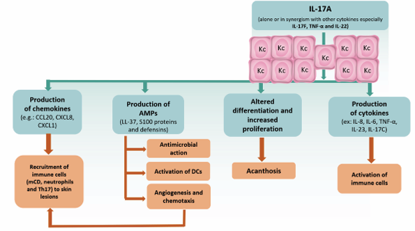 Potential roles of interleukin (IL)-17A in the pathogenesis of plaque psoriasis. IL-17A acts on keratinocytes (KCs) to stimulate production  of AMPs, proinflammatory chemokines and cytokines. DCs: dendritic cells; AMPs: antimicrobial peptides.