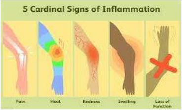 Phases of inflammation and their end result.