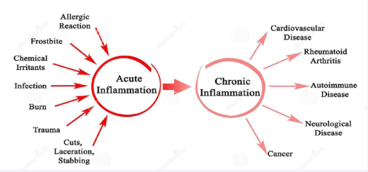 Graphic representation of inputs for Acute inflammation and then acute inflammation becomes chronic inflammation wgat sort of diseases can develope. Image Source: Inside Out Health And Wellness.