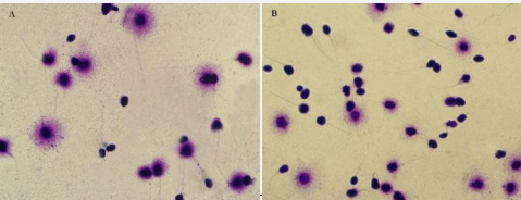 Sperm DNA Fragmentation based on halo formation in two groups - (sperm DNA Fragmentation) Examined by Olympus cx21 light microscope. Magnification 100X A: Fresh group B: Freezing group. Sperm nucleus with large halo (without DNA Fragmentation), sperm nucleus with small halo (with DNA Fragmentation) and sperm nucleus without halo (with severe damage of DNA).