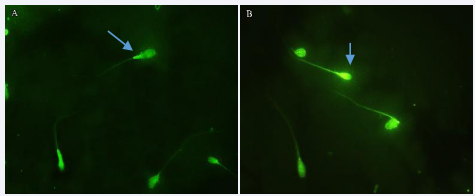 Evaluation of mitochondrial membrane potential of sperm using rhodamine 123 staining in two groups: A, Fresh group B, Freezing group. Healthy sperm with a bright green middle piece. Damaged sperm, lacking a bright green middle pice. (Olympus, DP71, Japan, 100x magnification)
