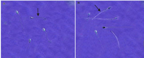 Evaluation of the integrity of the plasma membrane of human sperm using the HOS test method in two groups (Olympus, DP71, Japan) 100x magnification. A: Fresh group B: Freezing group. Sperm with a healthy plasma membrane with curved tail. Sperm with a damaged plasma membrane with a smooth tail.