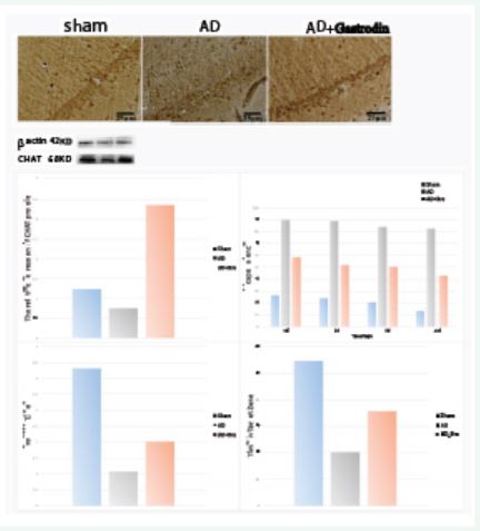 Figure 1 Breviscarpine Gastrodin treatment leads to improvement of cognitive function in rats subjected to AD. Immunohistochemical staining of CHAT in the hippocampus among the sham, AD and AD+Gastrodin group. Comparison of the CHAT protein levels among the sham, AD and AD+Gastrodin group. Comparison of the average escape latency to the hidden platform during the four days’ training session among these three groups. Comparison of the average number of crossings of the platform area during the probe test. Comparison of the times of the rats lingered in the target quadrant in the probe test. Data was expressed as means±SD.