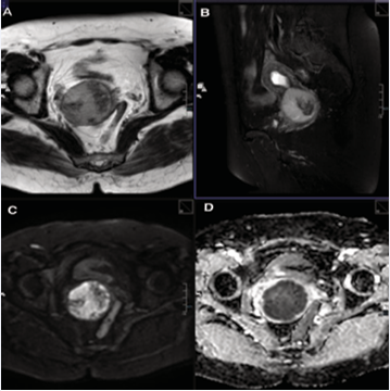https://www.jscimedcentral.com/public/assets/images/uploads/image-1782711231-1.PNG